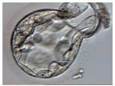 blastocyst1.jpg